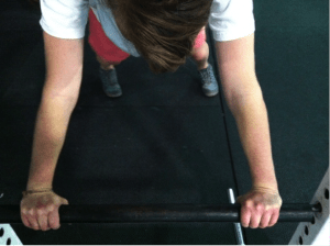 Elbow Hyperextension